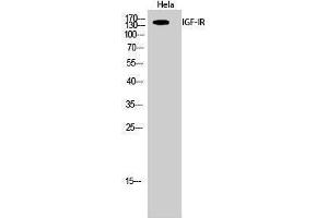 Western Blotting (WB) image for anti-Insulin-Like Growth Factor 1 Receptor (IGF1R) (Ser1026) antibody (ABIN3175593) (IGF1R 抗体  (Ser1026))
