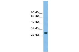 WB Suggested Anti-TSPAN4 Antibody Titration: 0. (TSPAN4 抗体  (Middle Region))