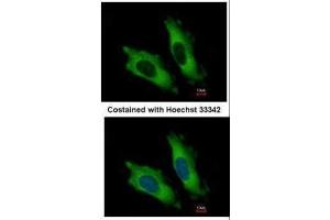 ICC/IF Image Immunofluorescence analysis of methanol-fixed HeLa, using EIF4A2, antibody at 1:500 dilution. (EIF4A2 抗体)