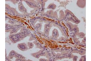 Immunohistochemistry (IHC) image for anti-Transient Receptor Potential Cation Channel, Subfamily M, Member 8 (TRPM8) antibody (ABIN7127855)