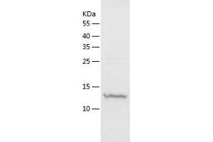 Western Blotting (WB) image for Chemokine (C-C Motif) Ligand 2 (CCL2) (AA 24-148) protein (His-IF2DI Tag) (ABIN7122280)