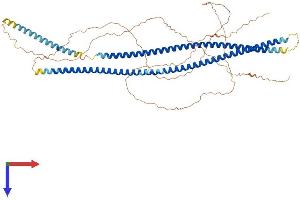 Cytokeratin 2 Protein (AA 1-638) (His tag)
