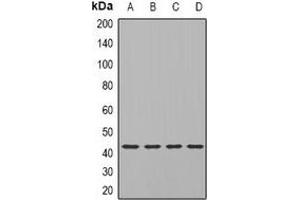 Western blot analysis of TIA1 expression in SKOV3 (A), Hela (B), mouse brain (C), rat brain (D) whole cell lysates. (TIA1 抗体)