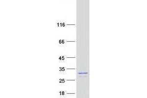 Validation with Western Blot (UBE2K Protein (Transcript Variant 1) (Myc-DYKDDDDK Tag))