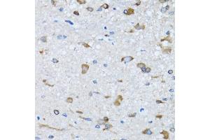Immunohistochemistry of paraffin-embedded mouse spinal cord using RARS antibody (ABIN5973728) at dilution of 1/100 (40x lens). (RARS 抗体)