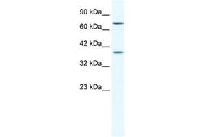Western Blotting (WB) image for anti-Zinc Finger Protein 660 (ZNF660) antibody (ABIN2461324) (ZNF660 抗体)