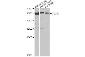 Western blot analysis of extracts of various cell lines, using CD200 antibody (ABIN2561685) at 1:1000 dilution. (CD200 抗体)