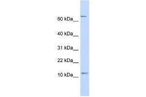 TRA16 antibody used at 1 ug/ml to detect target protein. (NR2C2AP 抗体  (N-Term))