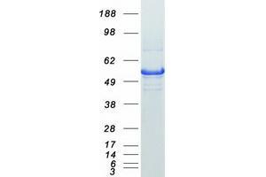 Western Blotting (WB) image for Autophagy related 4C Cysteine Peptidase (ATG4C) (Transcript Variant 8) protein (Myc-DYKDDDDK Tag) (ABIN2714796)