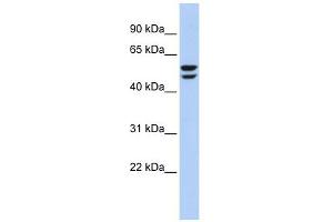 ATP6V1B2 antibody used at 1 ug/ml to detect target protein. (ATP6V1B2 抗体  (N-Term))