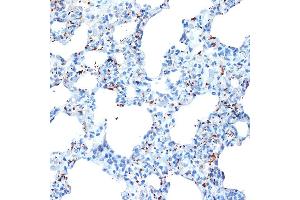 Immunohistochemistry of paraffin-embedded rat lung using CXCL4/CXCL4/PF4 Rabbit mAb (ABIN1683188, ABIN3017983, ABIN3017984 and ABIN7101555) at dilution of 1:100 (40x lens). (PF4 抗体)