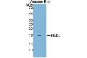 Western blot analysis of the recombinant protein. (CST5 抗体  (AA 21-142))