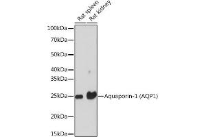 Western blot analysis of extracts of various cell lines, using Aquaporin-1 (Aquaporin-1 ) Rabbit mAb (ABIN1682901, ABIN3018679, ABIN3018680 and ABIN7101646) at 1:1000 dilution. (Aquaporin 1 抗体)