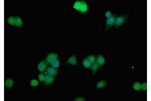 Immunofluorescent analysis of PC-3 cells using ABIN7144300 at dilution of 1:100 and Alexa Fluor 488-congugated AffiniPure Goat Anti-Rabbit IgG(H+L) (ANO1 抗体  (AA 1-151))