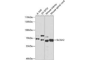 Western blot analysis of extracts of various cell lines, using SLC6 antibody (ABIN6130907, ABIN6148042, ABIN6148043 and ABIN6218497) at 1:1015 dilution. (SLC6A2 抗体  (AA 1-70))