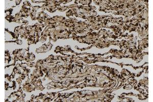 ABIN6261376 and ABIN6277015 at 1/100 staining Human lung tissue by IHC-P. (Dystonin 抗体  (C-Term))