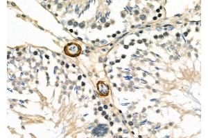 ABIN6260728 and ABIN6277053 at 1/100 staining Rat testis tissue by IHC-P. (CDKN3 抗体  (Internal Region))