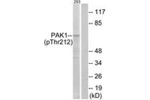 Western blot analysis of extracts from 293 cells treated with etoposide 25uM 1h, using PAK1 (Phospho-Thr212) Antibody. (PAK1 抗体  (pThr212))