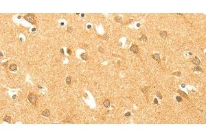 Immunohistochemistry of paraffin-embedded Human brain using AARS2 Polyclonal Antibody at dilution of 1:40 (AARS2 抗体)