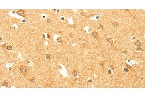 Immunohistochemistry of paraffin-embedded Human brain using AARS2 Polyclonal Antibody at dilution of 1:40 (AARS2 抗体)