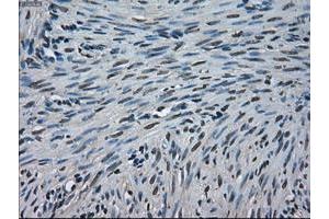 Image no. 1 for anti-Crystallin, alpha B (CRYAB) antibody (ABIN1497641) (CRYAB 抗体)
