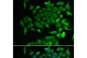 Immunofluorescence analysis of MCF-7 cells using RBP2 Polyclonal Antibody (RBP2 抗体)