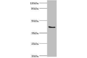 Western blot All lanes: ADAP1 antibody at 2 μg/mL + Rat brain tissue Secondary Goat polyclonal to rabbit IgG at 1/10000 dilution Predicted band size: 44, 45, 36 kDa Observed band size: 44 kDa (ADAP1 抗体  (AA 1-374))