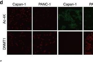 Immunofluorescence (Cultured Cells) (IF (cc)) image for anti-DNA (Cytosine-5)-Methyltransferase 1 (DNMT1) (AA 1-270) antibody (ABIN6139745)