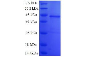 SDS-PAGE (SDS) image for C1D Nuclear Receptor Corepressor (C1D) (AA 1-135), (partial) protein (GST tag) (ABIN7479613)