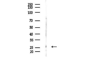 Western blot analysis of lysates from HepG2 cells(LPS, 4h treatment), using MMAB Antibody at 1/1000 dilution.