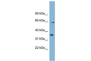 WB Suggested Anti-RANGAP1 Antibody Titration: 0. (RANGAP1 抗体  (N-Term))