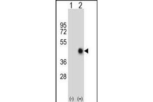 Western blot analysis of FAS (arrow) using rabbit polyclonal FAS Antibody (Center) (ABIN652469 and ABIN2842320). (FAS 抗体  (AA 185-211))