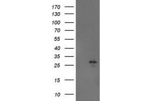 Western Blotting (WB) image for anti-Adenylate Kinase 4 (AK4) antibody (ABIN1496524) (AK4 抗体)