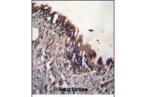 Immunohistochemistry (Paraffin-embedded Sections) (IHC (p)) image for anti-Nudix (Nucleoside Diphosphate Linked Moiety X)-Type Motif 9 (NUDT9) (AA 318-346), (C-Term) antibody (ABIN656174)