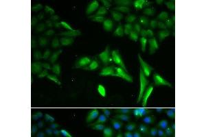 Immunofluorescence analysis of U2OS cells using ACADS Polyclonal Antibody (ACADS 抗体)