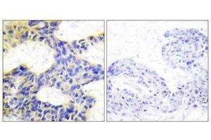 Immunohistochemistry (IHC) image for anti-Ribosomal Protein S6 Kinase, 70kDa, Polypeptide 1 (RPS6KB1) (Internal Region) antibody (ABIN1849255) (RPS6KB1 抗体  (Internal Region))