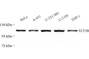 Western blot analysis of STT3B (ABIN7075745) at dilution of 1: 2000 (STT3B 抗体)