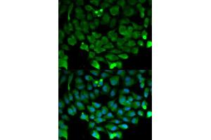Immunofluorescence analysis of HeLa cell using CUL3 antibody. (Cullin 3 抗体  (AA 569-768))