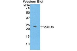 Western Blotting (WB) image for anti-Dishevelled, Dsh Homolog 2 (Drosophila) (DVL2) (AA 78-250) antibody (ABIN1858675) (DVL2 抗体  (AA 78-250))