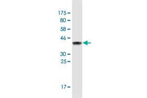 Western Blot detection against Immunogen (36. (MTMR3 抗体  (AA 579-674))