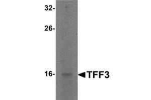 Western blot analysis of TFF3 in rat small intestine tissue lysate with TFF3 antibody at 2 μg/ml. (TFF3 抗体  (C-Term))