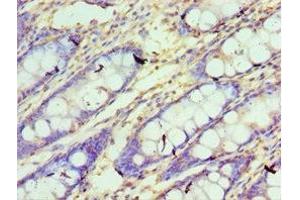 Immunohistochemistry of paraffin-embedded human colon tissue using ABIN7148780 at dilution of 1:100 (CXXC1 抗体  (AA 1-210))