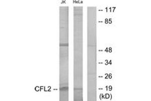 Western blot analysis of extracts from Jurkat/HeLa cells, using Cofilin Antibody.
