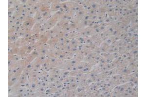 IHC-P analysis of Human Liver Tissue, with DAB staining. (DCLK1 抗体  (AA 390-647))