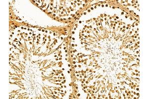 ABIN7094608 and ABIN7098658 at 1/100 staining Rat testis tissue by IHC-P. (MCM10 抗体  (C-Term))