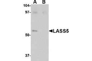 Western Blotting (WB) image for anti-LAG1 Homolog, Ceramide Synthase 5 (LASS5) (C-Term) antibody (ABIN1030478) (LASS5 抗体  (C-Term))