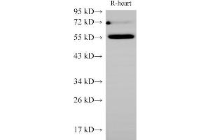 Western Blot analysis of Rat Heart using Ceacam1 Polycloanl Antibody at dilution of 1:1000 (CEACAM1 抗体)