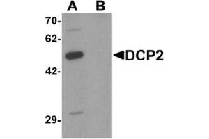 Western blot analysis of DCP2 in 293 cell lysate with DCP2 Antibody  at 1 μg/ml in (A) the absence and (B) the presence of blocking peptide. (DCP2 抗体  (C-Term))