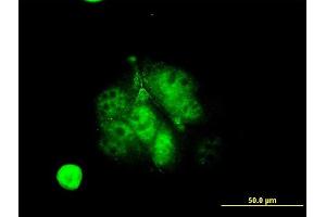 Immunofluorescence of monoclonal antibody to MEF2A on MCF-7 cell. (MEF2A 抗体  (AA 71-170))