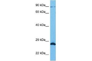 Host:  Rabbit  Target Name:  SUN1  Sample Tissue:  Human HCT116 Whole Cell  Antibody Dilution:  1ug/ml (SUN1 抗体  (N-Term))